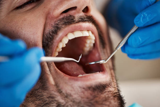 Best Dentist for Severe Toothache  in North Judson, IN